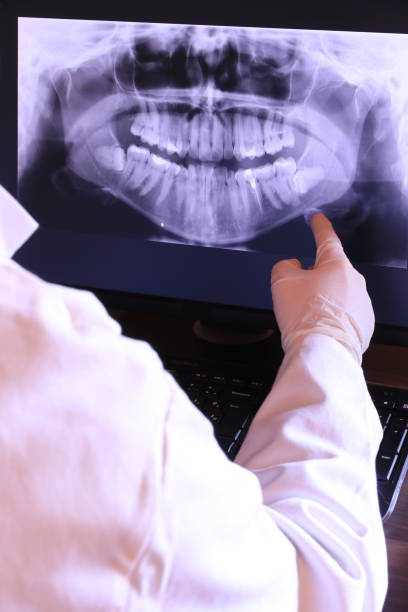 Best Emergency Root Canal Treatment in Granbury, TX