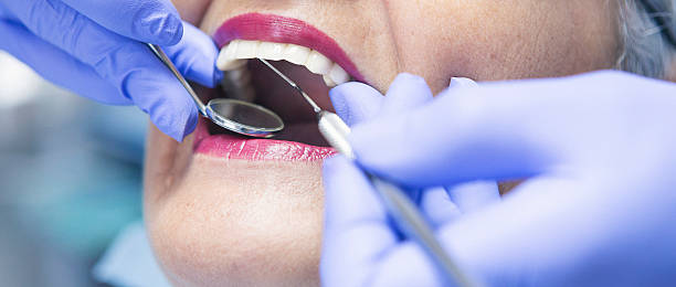 Best Emergency Gum Treatment in Granbury, TX
